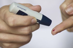 Ernährung bei Arthrose Diabetes